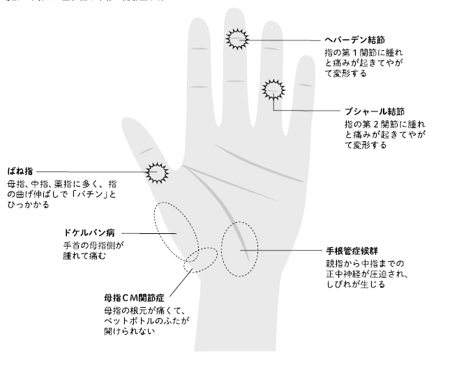 全身の痛み 筋肉痛 関節の症状 頭痛 肩こり 腰痛 関節痛 全身が痛い 指のこわばりなど 一般社団法人女性の健康とメノポーズ協会 全身の痛み 筋肉痛 関節の症状 頭痛 肩こり 腰痛 関節痛 全身が痛い 指のこわばりなど 一般社団法人女性の健康とメノポーズ協会