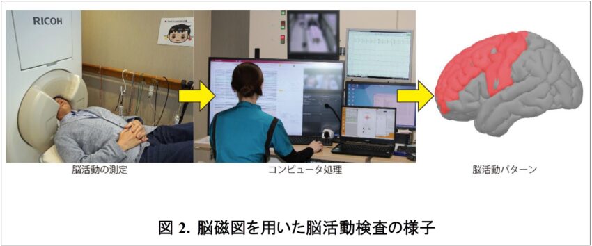 脳磁図を用いた脳活動検査の様子