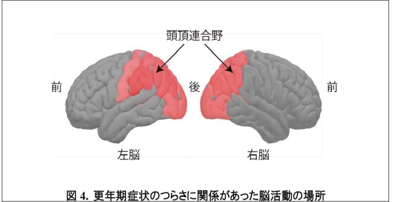 更年期症状のつらさに関係があった脳活動の場所